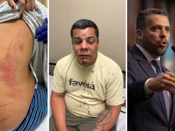 Violência política: no Rio, candidato petista é agredido 