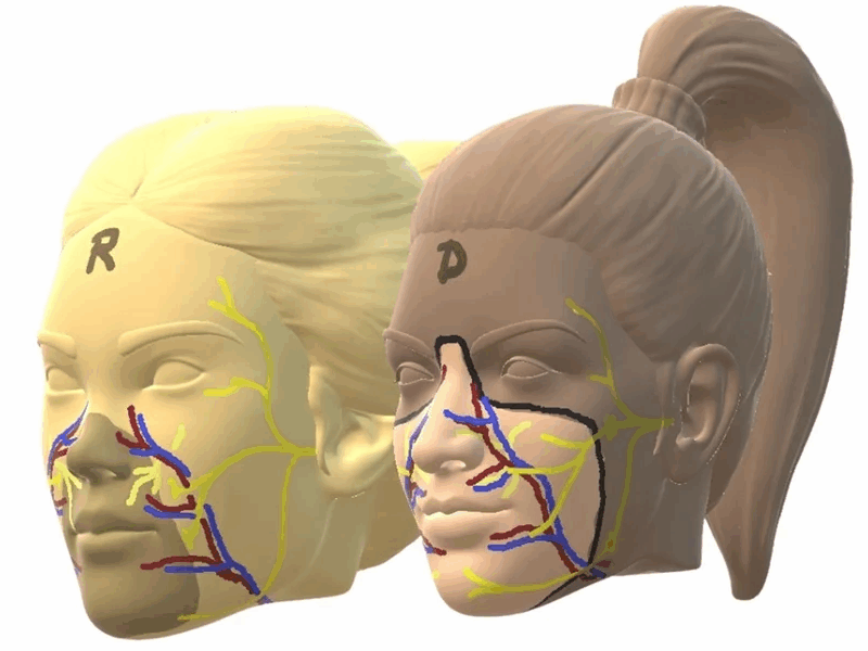 Primeiro transplante facial é realizado com doadora que optou por morte assistido