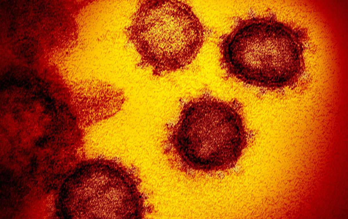 Coronavírus: Microscopia e o Desafio Global da Saúde