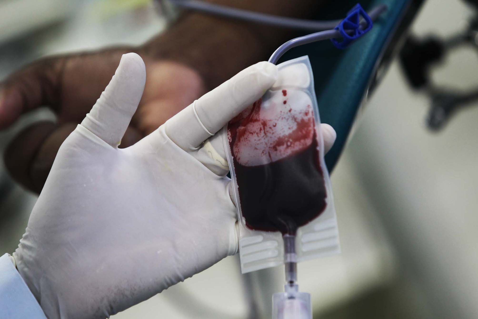 Mão Enluvada Segura Bolsa de Sangue
