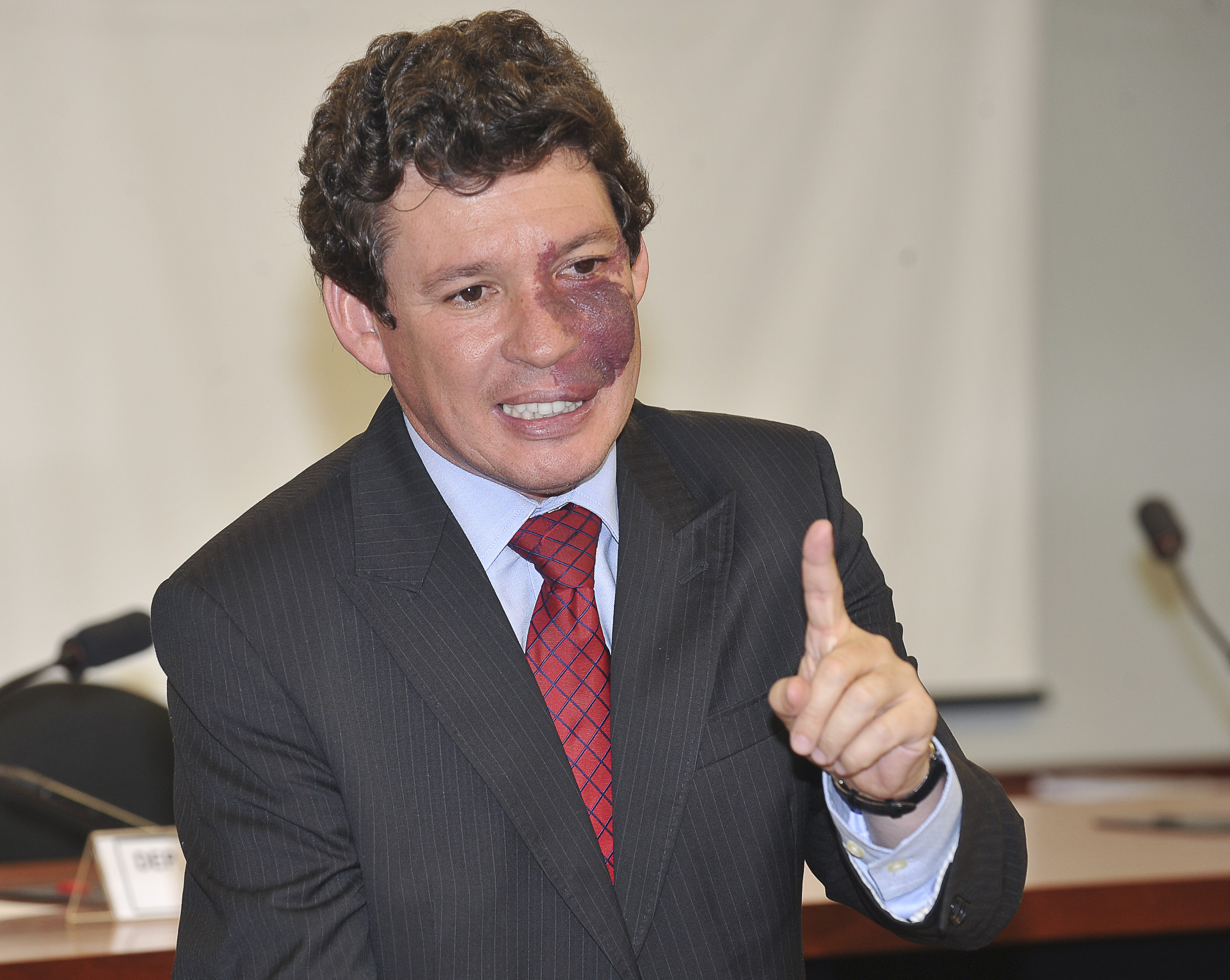 Líder com marca de nascença em discurso enfático